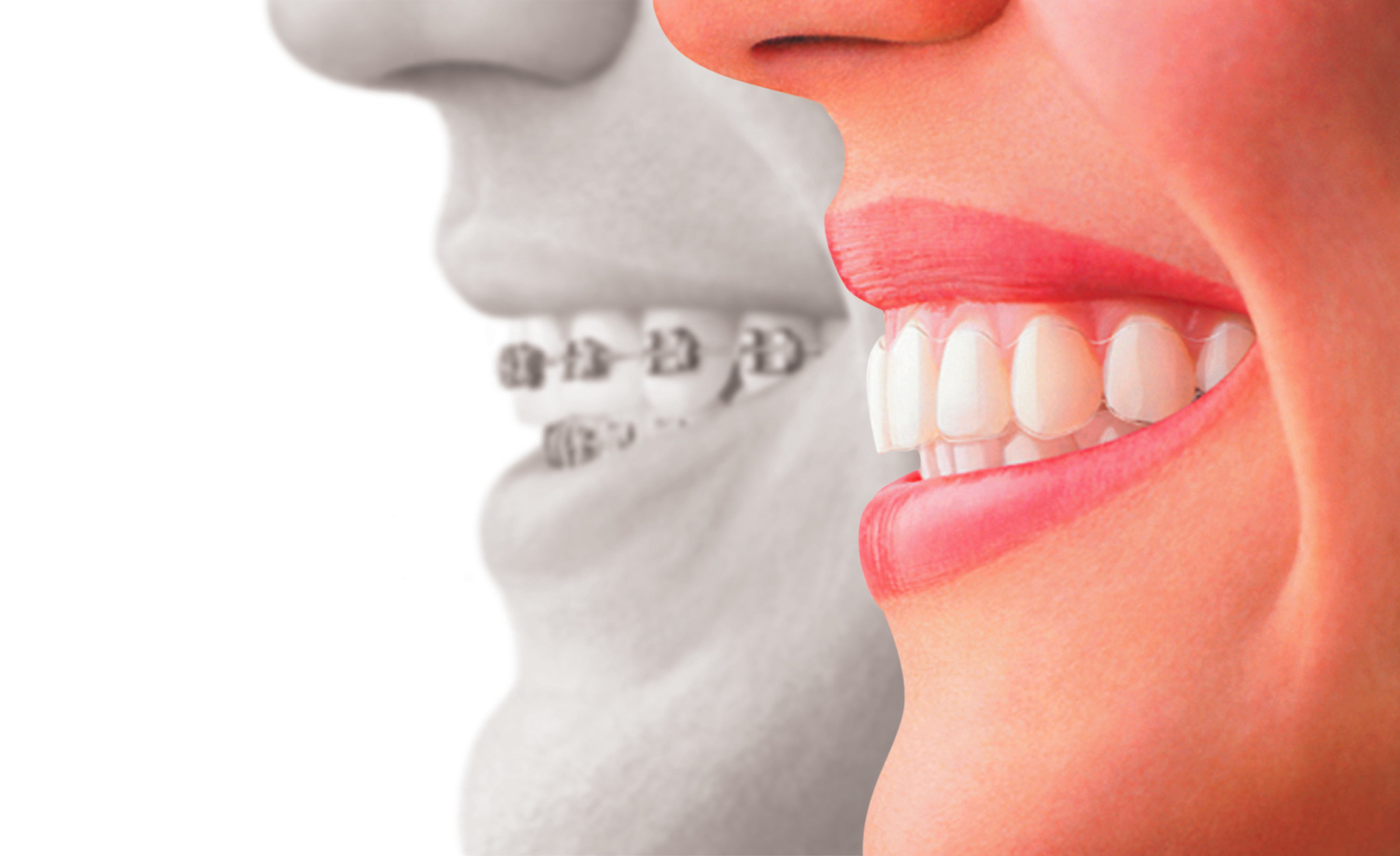 Orthodontic treatment options in North Vancouver